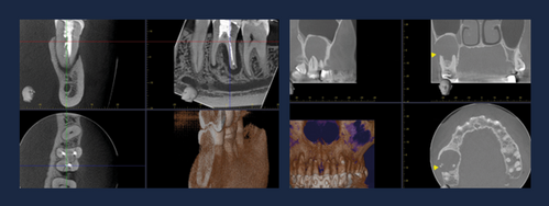CBCT-kurs-bilder.png